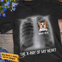 Personalized X Ray Of My Heart Dog T Shirt AP53 73O36 thumb 1